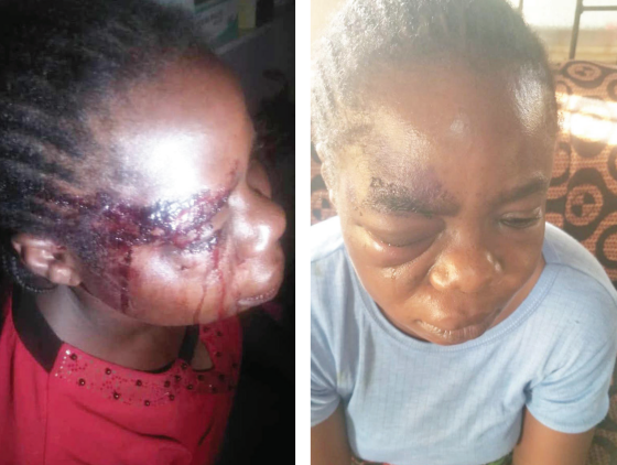 Man who fled home after injuring wife’s eyes arrested in Osun